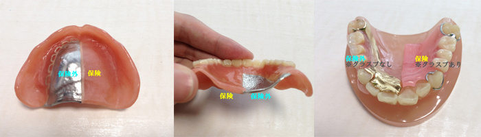 入れ歯の種類
